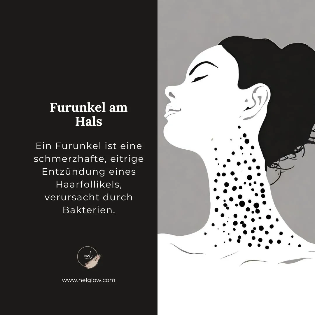 Pickel am Hals und Tipps um unreine Haut am Hals los zu werden — nelGlow